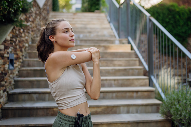 Jonge vrouw met bloedsuikersensor op arm rekt zich uit voor het sporten op een trap.